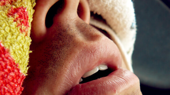 ‘Safety first’ crucial for sleep apnea patients, journal says