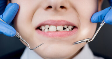 Improving oral health of people with intellectual disability