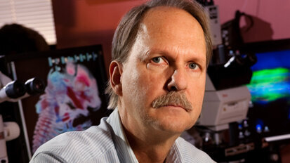 Dental Professor receives US$1.2 million to study bones and teeth