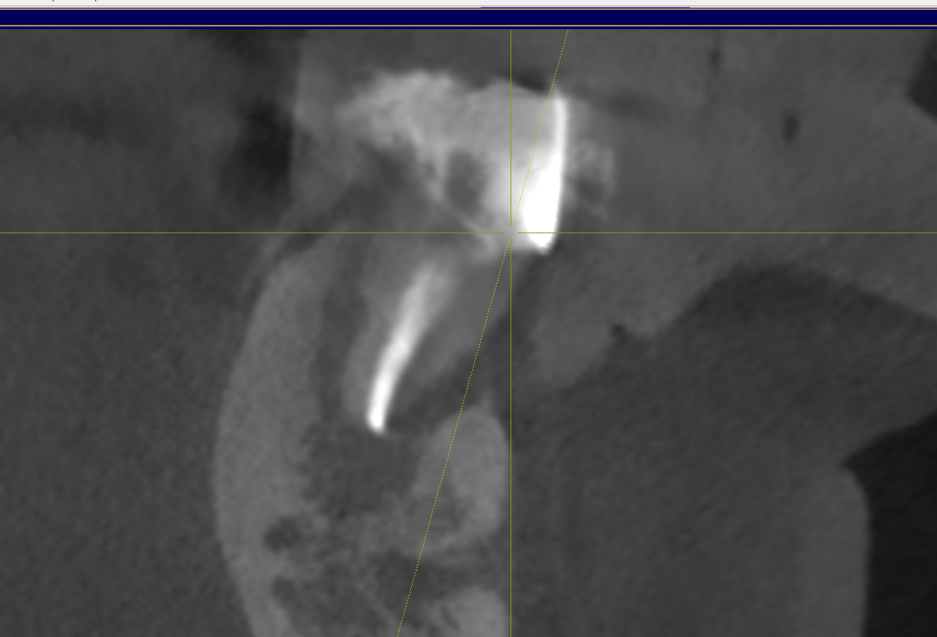 Fig. 2b.