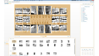 Curve Dental announces field testing of its Web-based Dental Imaging Software