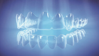 Invisalign, nuove funzioni SmartForce per supportare gli specialisti nel trattamento dei casi più complessi