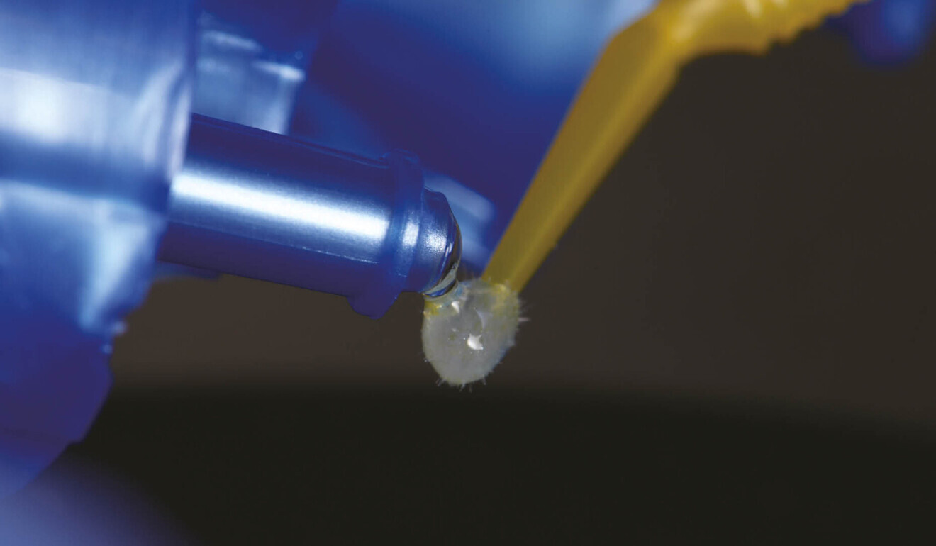 Fig. 4: PANAVIA V5 Tooth Primer, which was applied to the etched tooth surfaces.