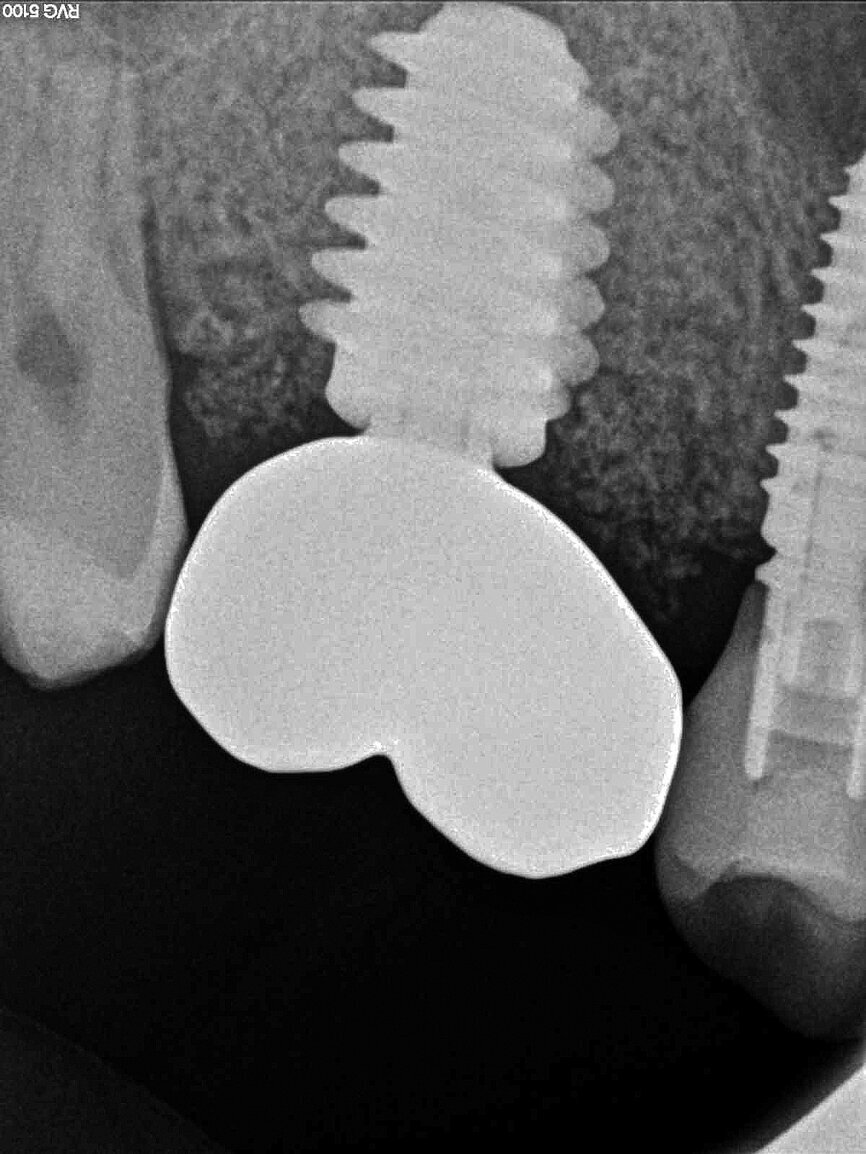Fig. 14