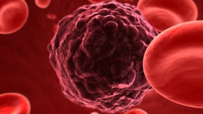 La Journée mondiale de lutte contre le cancer sous le signe de l'espoir