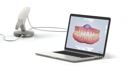 La solution d'empreinte numérique TRIOS Color de 3Shape inclut désormais une fonctionnalité de mesure des teintes dentaires