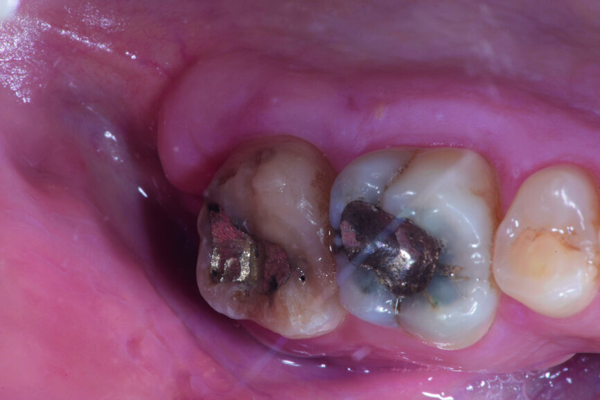 Fig. 11: Four weeks after transplantation.