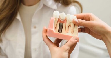 S3-Leitlinie Periimplantäre Weichgewebe-Augmentation