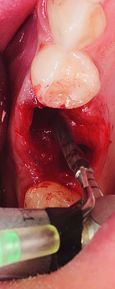 Fig. 4d