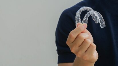 Treatment of ectopic canines with aligners and the MTA auxiliary