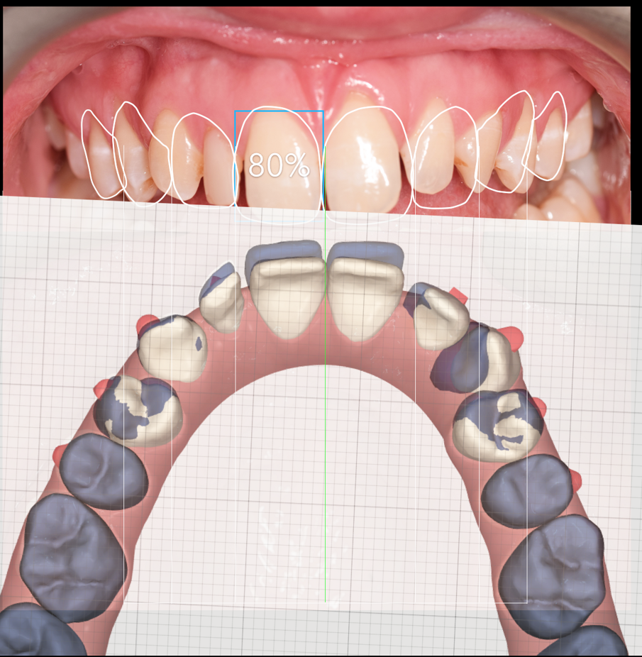 Fig. 1f