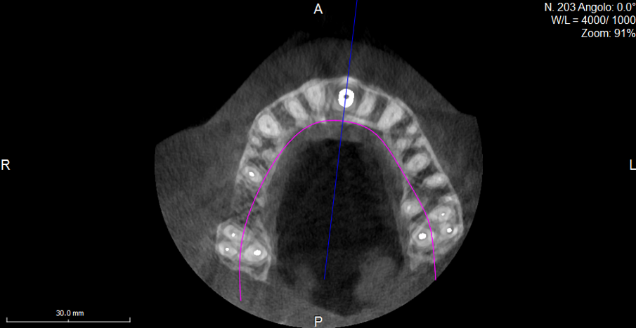 Fig. 23