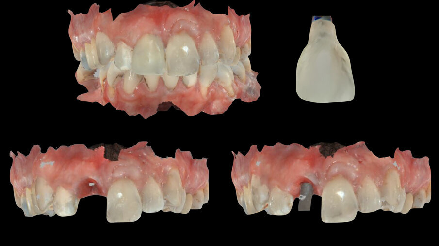 Fig. 18