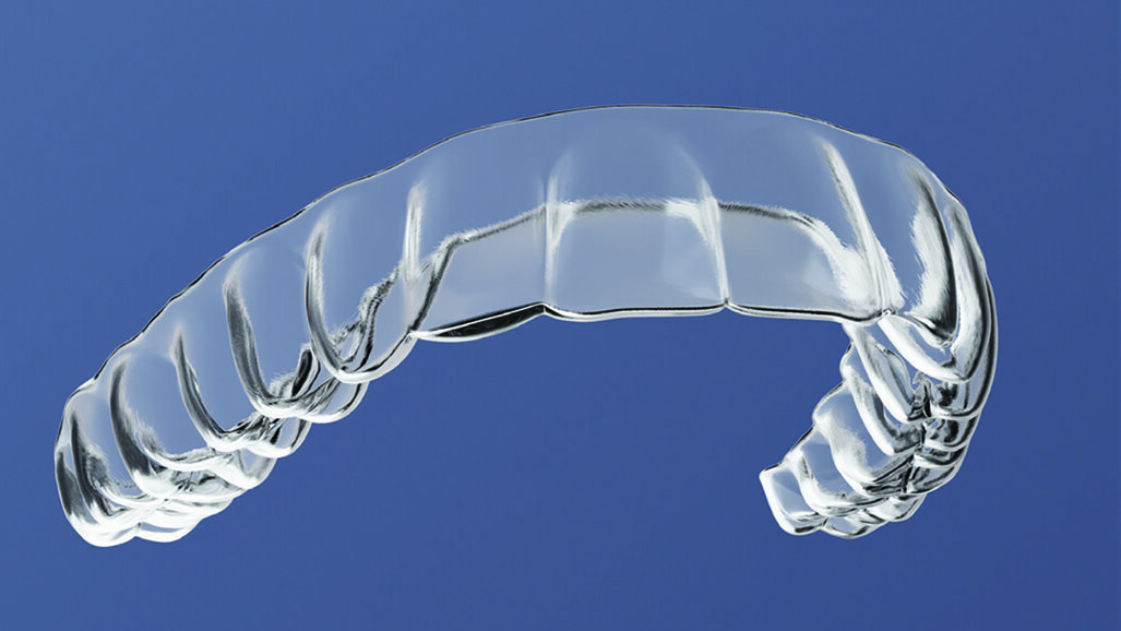 Rescue aligners are designed to get patients' aligner treatments back on track