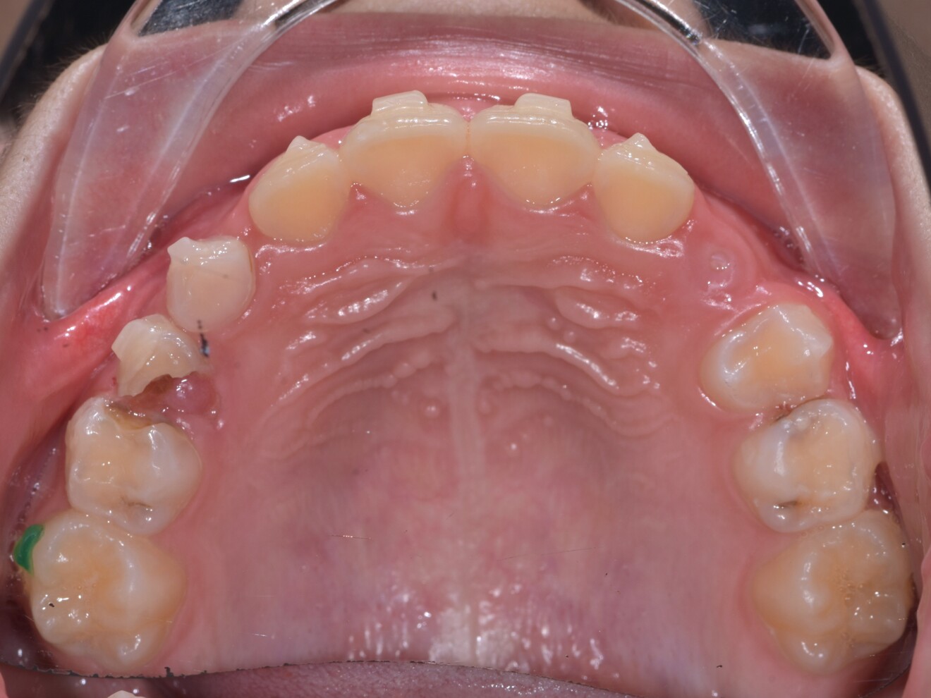 Fig. 2g