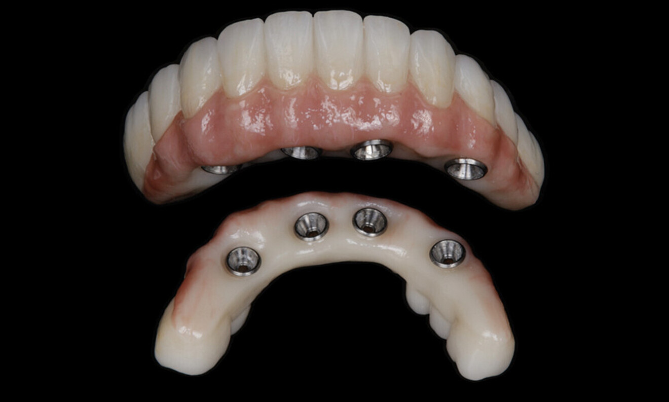Fig. 75