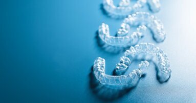Combination of a distaliser and aligners for Class II correction