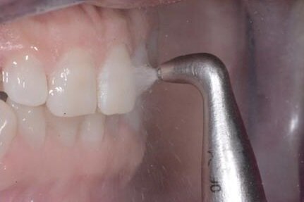 Fig. 8b