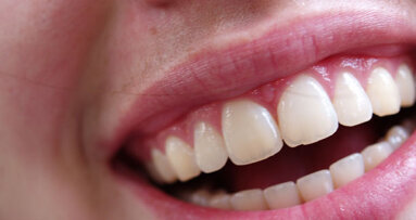 AAID: August is Dental Implant Month