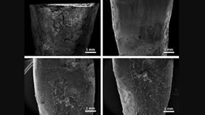 Preservation of root cementum:  A comparative evaluation of power-driven  versus hand instruments