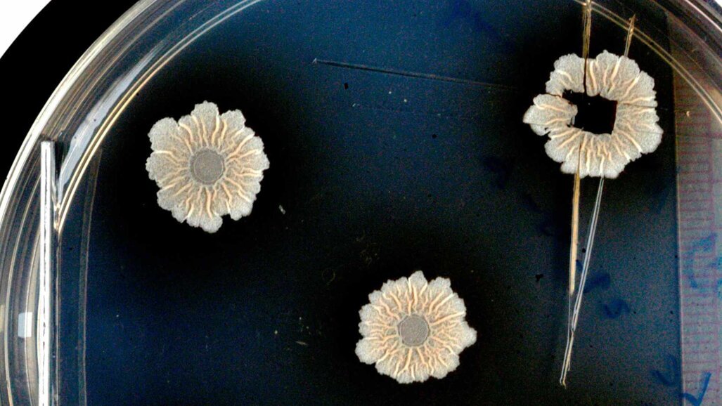 Strukturen des Biofilms und deren Auswirkungen entschlüsselt
