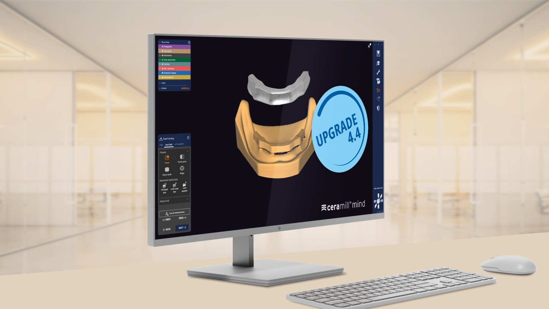 Dental News - Ceramill software Upgrade 4.4 focuses on time-savings and ...