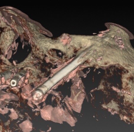 Fig. 24