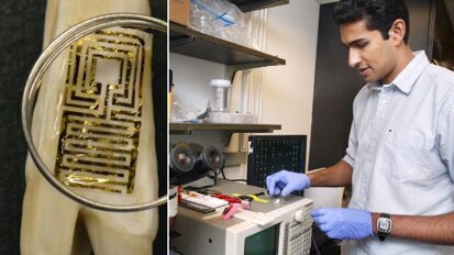 Engineers develop novel biosensor for use on teeth