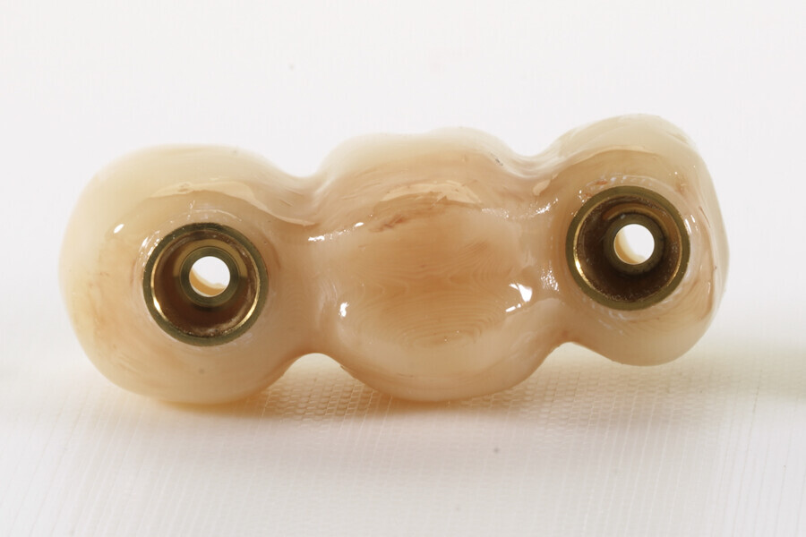 Fig. 11b