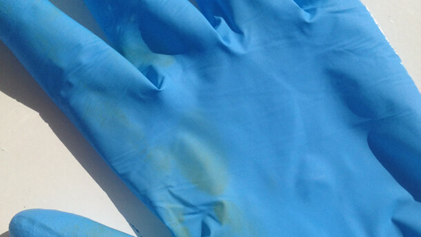 Contactallergie door handschoenen groeiend probleem