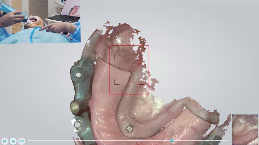 Fig. 11