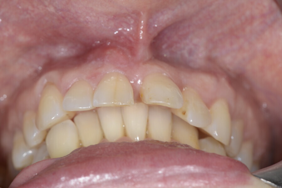 Fig. 4d