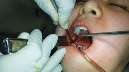 Extraction Academy can help clinicians take skills to next level