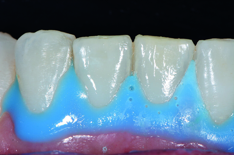 Fig. 14b