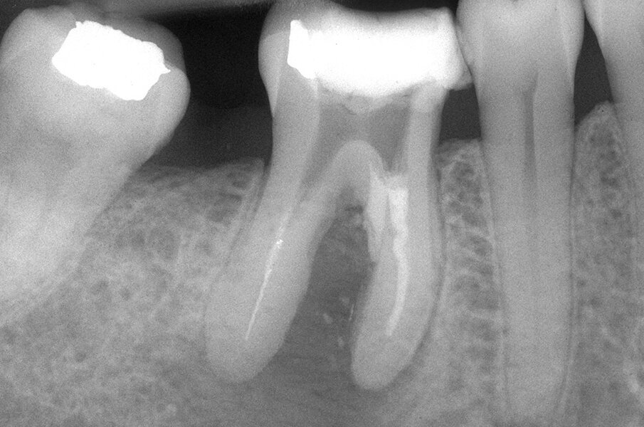 Fig. 3e