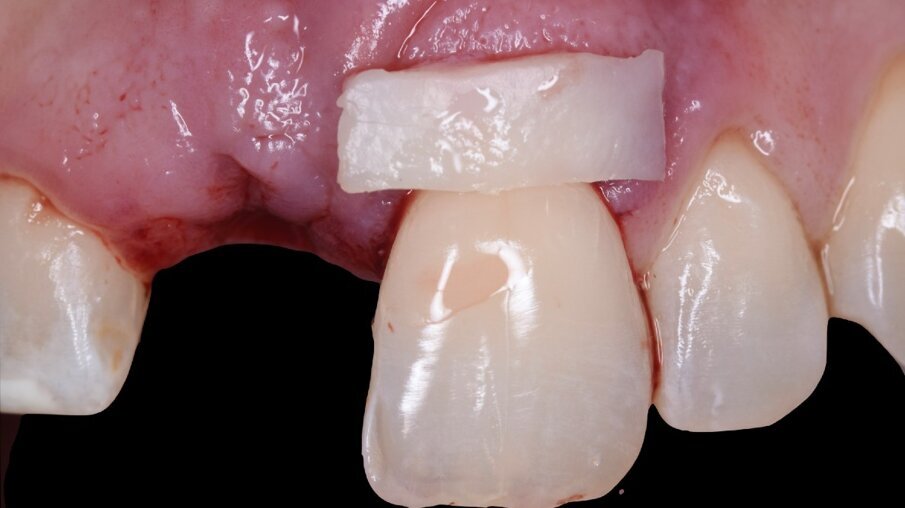 Fig. 11