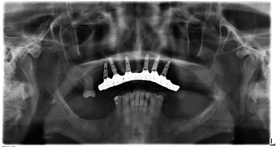 Fig. 9
