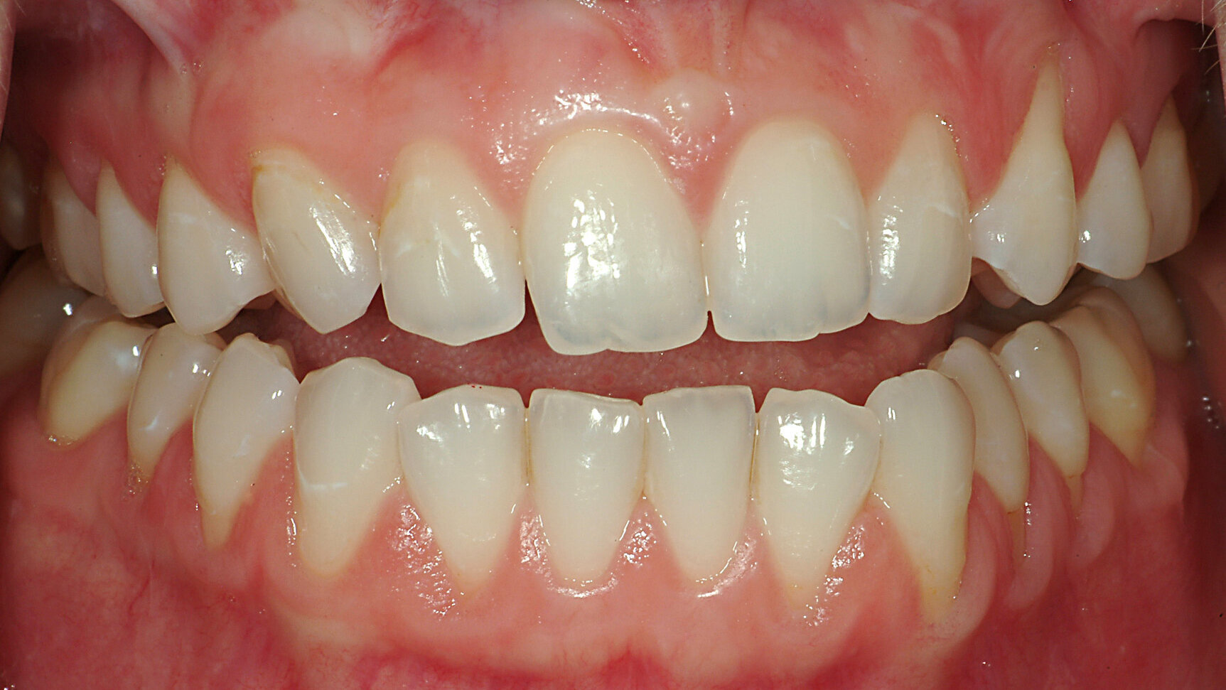 Occlusion principles for the practising dentist in the digital age