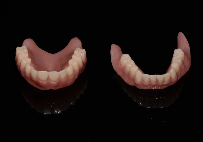 Fig. 21: Checking the fit of the denture bases and tooth segments.