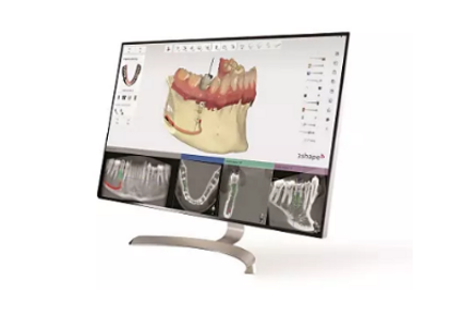 3Shape – Implant Studio