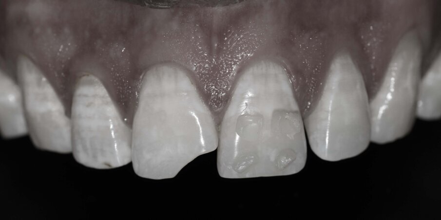 Fig 4: Monochromatic picture for selecting the Value