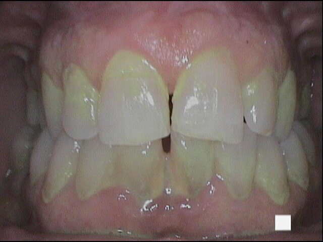 Fig. 2a