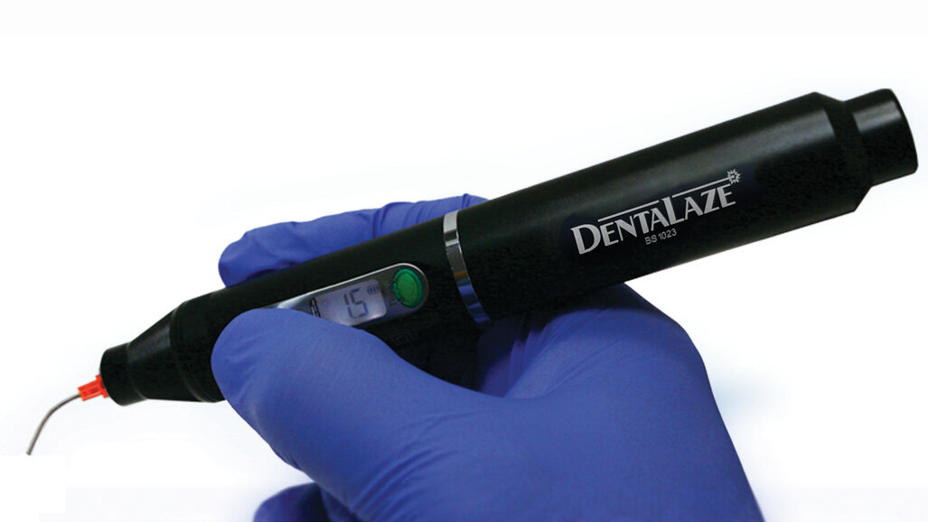 DentaLaze: new, cost-effective, wireless, soft-tissue diode laser