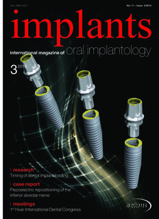 implants international