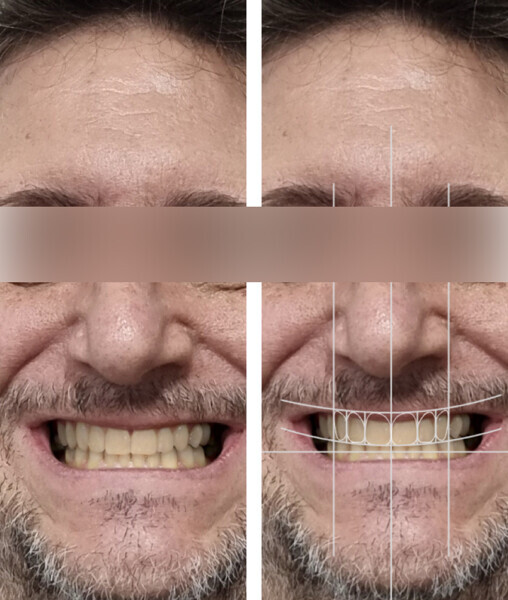 Fig. 18