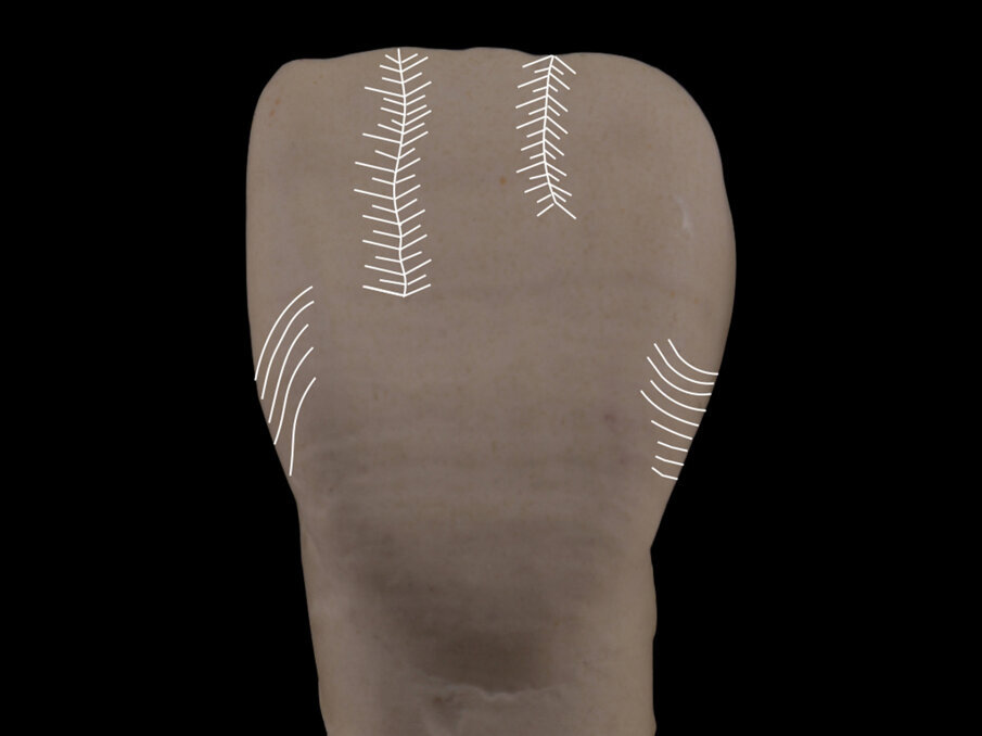 Fig. 12: Marked wavy vertical lines and small oblique segments of different directions create a detailed surface on the facial lobes. From the incisal edge towards the middle third of the tooth, the contrast between the rising and falling marks.