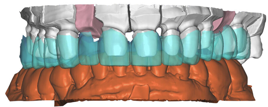 Fig. 52