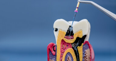 New glossary aims to standardise root and canal anatomy terminology