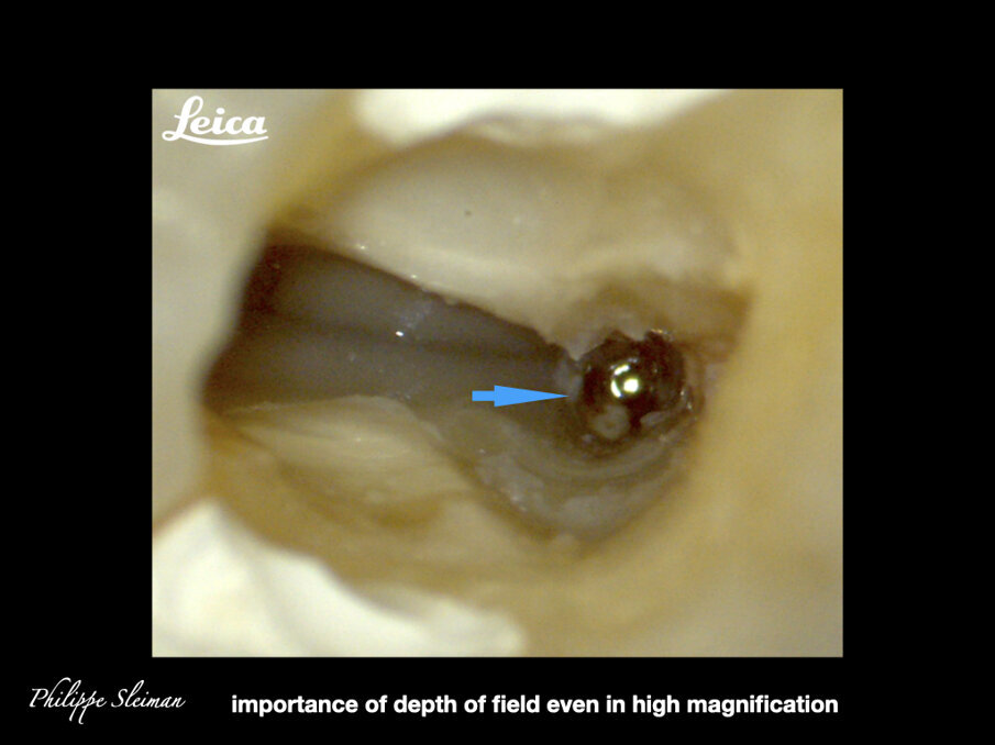 Fig. 13