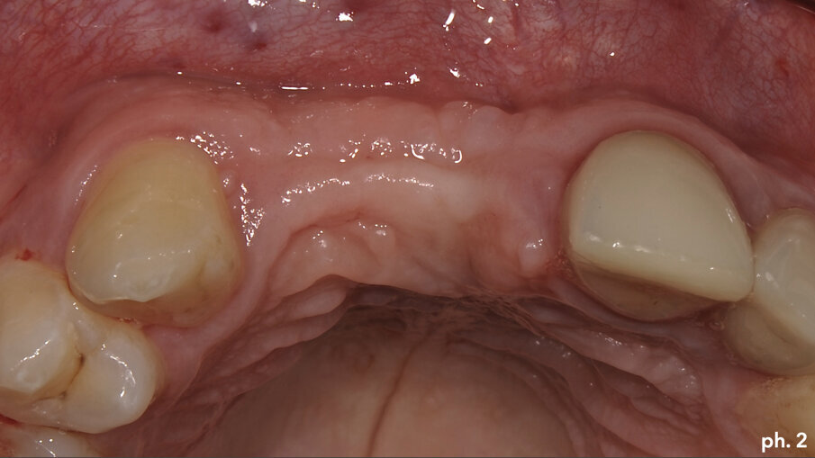 Fig. 2
